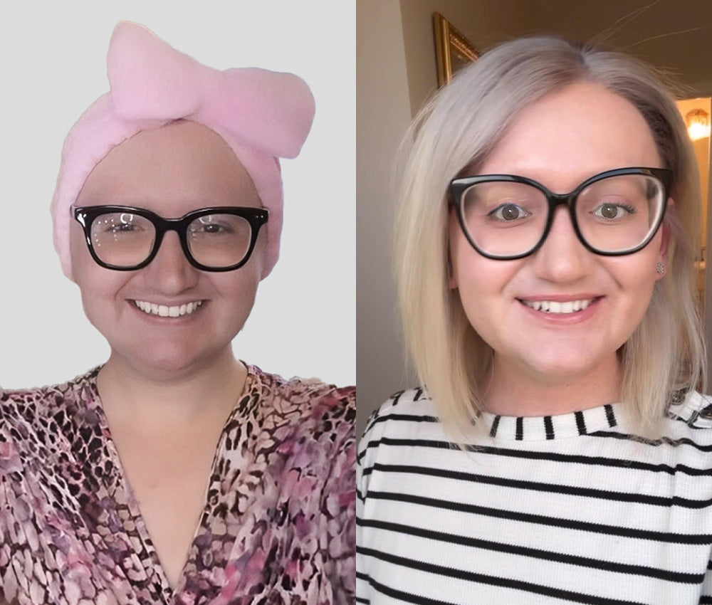 The before&after of Hormona_lisa