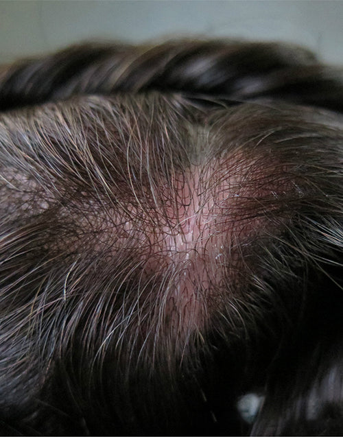 8"x10" Super Thin Skin 2-3mil V Loop All Over 6" Hair Toupee Hairpieces for Men Indian Cuticle Human Hair