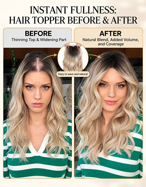 8"x8" Silk Top Human Hair Topper For Women Who Want to Transform Thinning hair and Renew Your Confidence Again