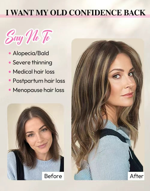 16" 7.5x7.5inch Large Base Highlights Hair Toppers For Women Zero-Net Real Human Hair Toppers With Thinning Hair For Daily Wear