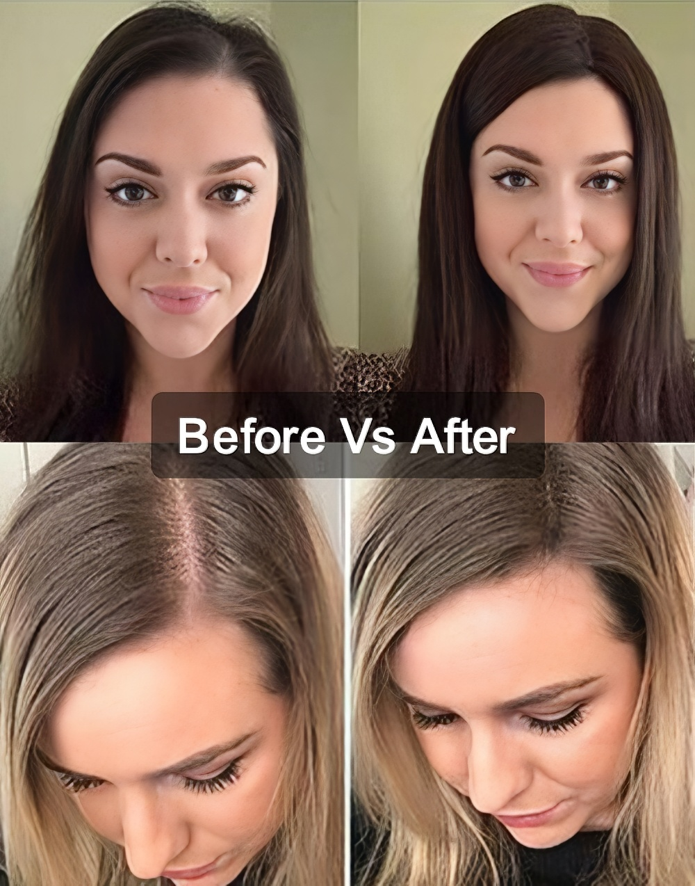 Medium Brown Highlights Hair Topper for Women, 8"x8" Silk Top Base, European Remy Human Hair, 14-20 Inch Mid Length