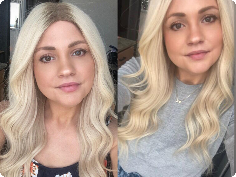 The before&after of Lauren Musser